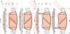 TRW GDB3503 Brake Pad Set, disc brake