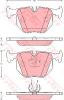 TRW GDB1527 Brake Pad Set, disc brake