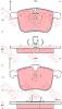 TRW GDB1567 Brake Pad Set, disc brake