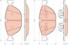 TRW GDB1728 Brake Pad Set, disc brake