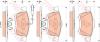 TRW GDB1864 Brake Pad Set, disc brake