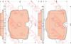 TRW GDB1869 Brake Pad Set, disc brake