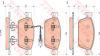 TRW GDB1887 Brake Pad Set, disc brake
