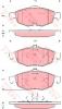TRW GDB4125 Brake Pad Set, disc brake