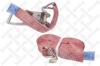 STELLOX 80-00103-SX (8000103SX) Tension Strap