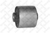 STELLOX 7700435SX Control Arm-/Trailing Arm Bush