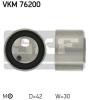 SKF VKM76200 Tensioner Pulley, timing belt