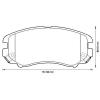 BENDIX 572514B Brake Pad Set, disc brake