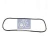 DT 2.11020 (211020) Gasket, housing cover (crankcase)