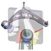 RTS 96-09569-198 (9609569198) Track Control Arm